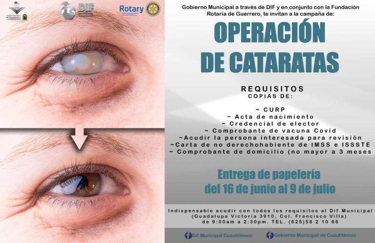 DIF de Cuauhtémoc abre registro para operaciones de cataratas