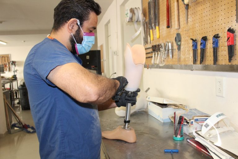 Beneficiará Gobierno del Estado con prótesis de pierna para personas con discapacidad en Chihuahua, Juárez y Cuauhtémoc